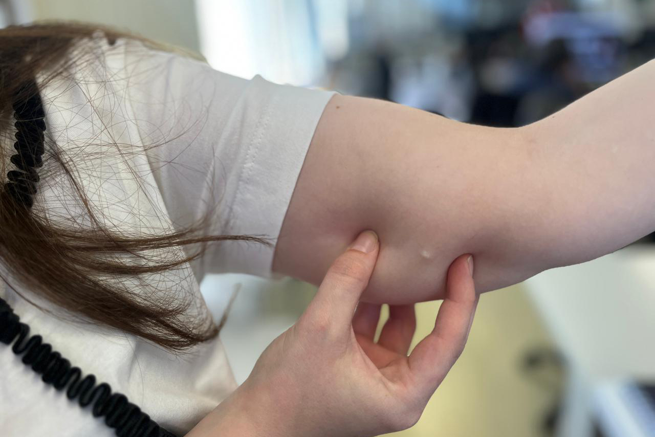 SESA - Implante contraceptivo de até R$ 4 mil chega gratuitamente ao SUS no PR