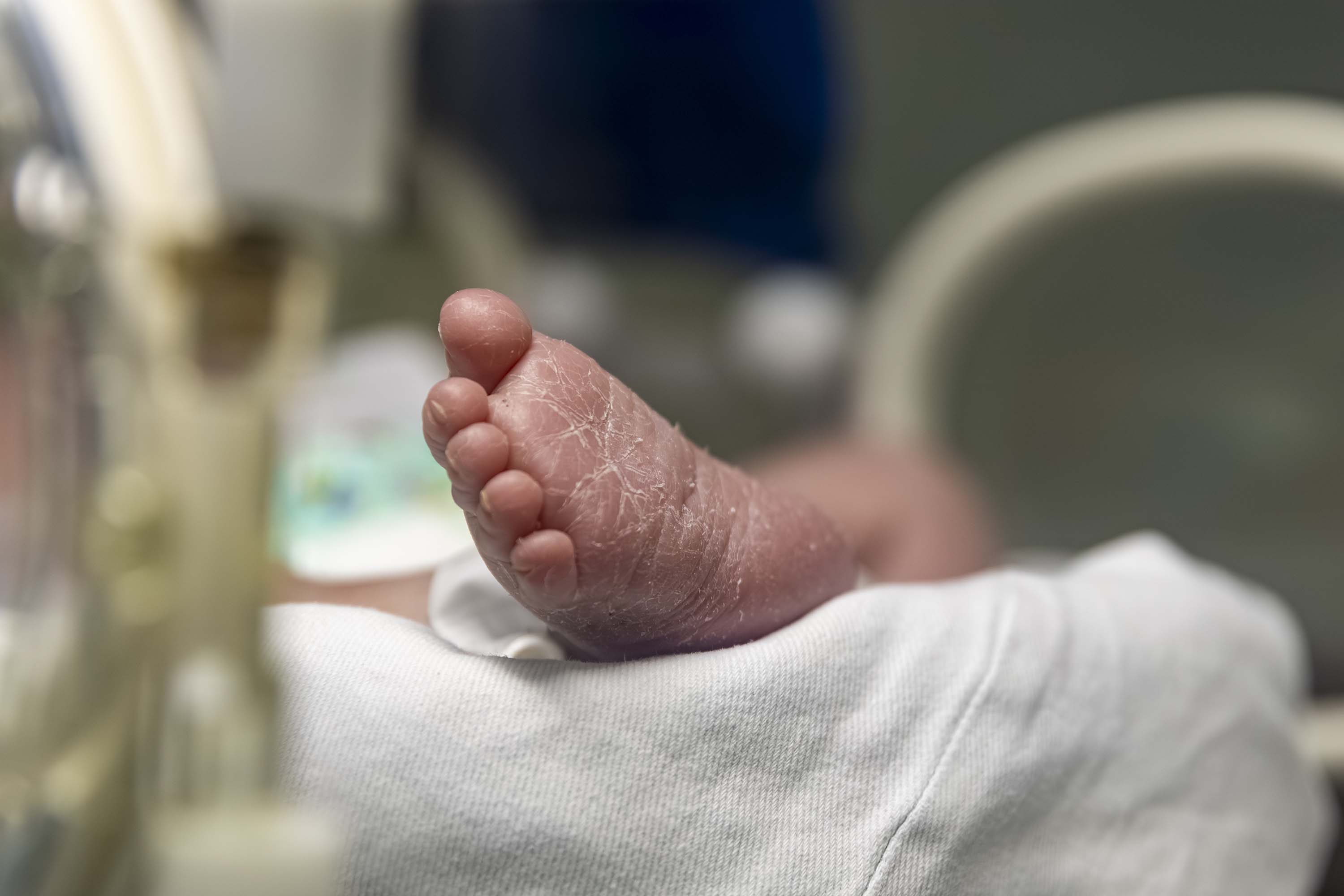 SESA - Mães de bebês prematuros recebem apoio em saúde mental no PR