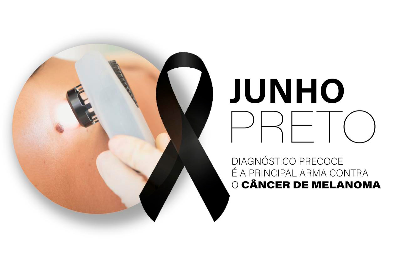 Diagnóstico precoce é a principal arma contra o melanoma