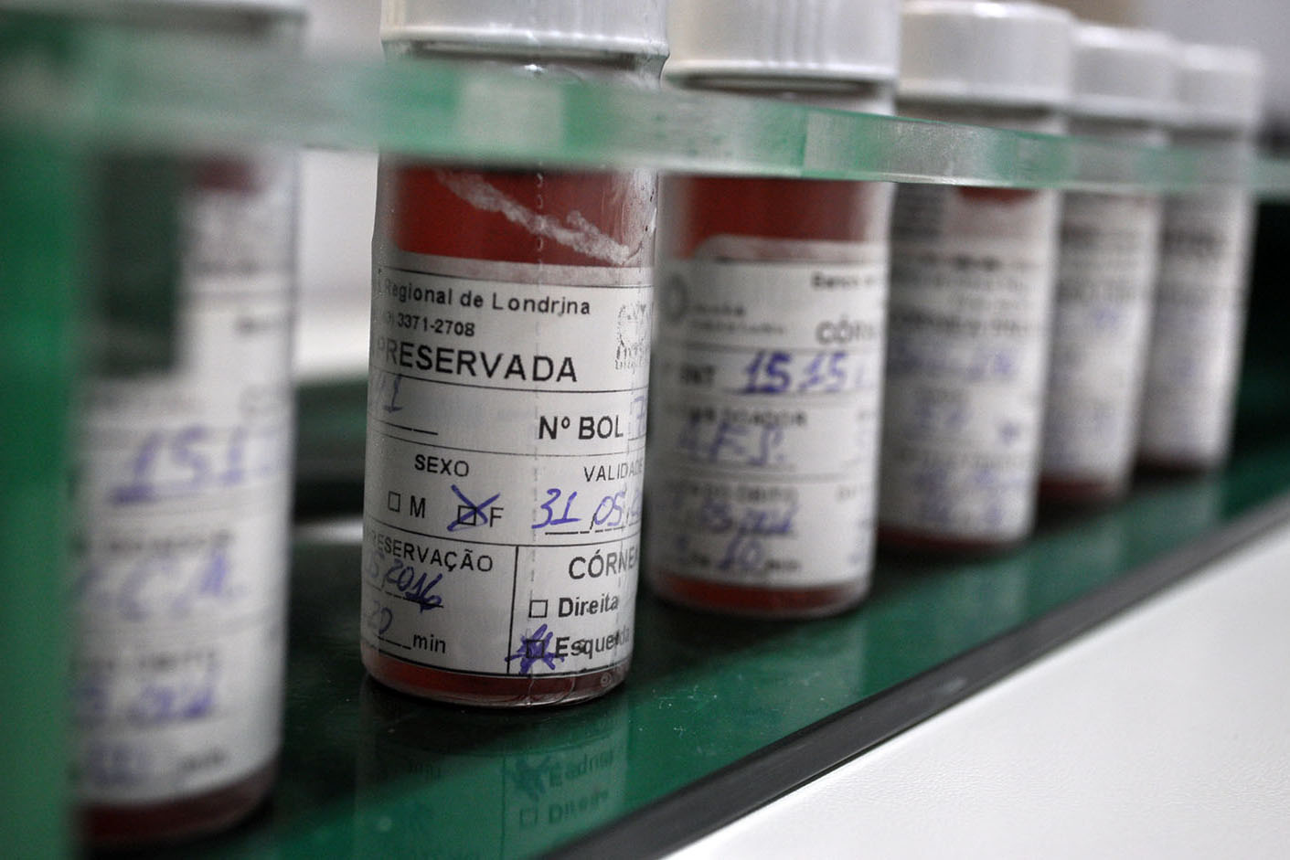 Doação de tecidos ajuda a recuperar queimados, tratar doenças e até devolver a visão