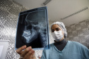 Caif volta atender 100% pacientes com malformação facial 