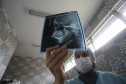 Caif volta atender 100% pacientes com malformação facial 