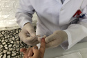Sesa promove ações para diagnóstico precoce e prevenção do HIV/AIDS no Dezembro Vermelho 