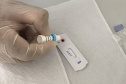 Sesa promove ações para diagnóstico precoce e prevenção do HIV/AIDS no Dezembro Vermelho 