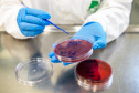 SESA Doenças do estômago e intestino já afetou mais de 389 mil paranaenses este ano