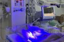 Hospitais da rede estadual implantam primeira UTI Neonatal Neurológica