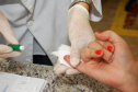 Julho amarelo alerta sobre os cuidados de prevenção das hepatites
. Foto:Arquivo SESA
