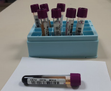 Em seis meses, cadastro de medula óssea no Paraná originou seis transplantes exitosos pela compatibilidade  
