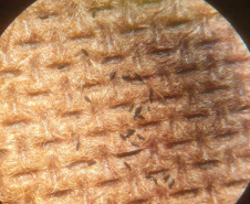 DENGUE