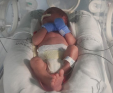 No Dia Mundial da Prematuridade, Governo reforça compromisso com o cuidado contínuo aos recém-nascidos