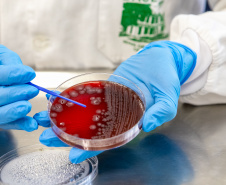 SESA - Verão com saúde: Sesa orienta para cuidados com viroses e outras intoxicações