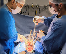 SESA - Paraná é referência em cirurgias de deformidade da coluna vertebral