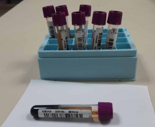 Fevereiro Laranja: a luta contra a leucemia e a importância do diagnóstico precoce