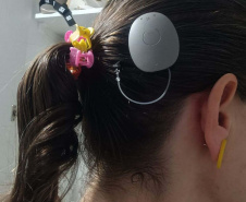 Paraná assume liderança nacional em implantes cocleares pelo SUS