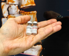 Hospitaldo Trabalhador realiza a primeira aplicação de polilamimina