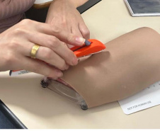 Implante contraceptivo chega a quase 2 mil mulheres no Paraná em 2026 e Paraná amplia capacitação de profissionais