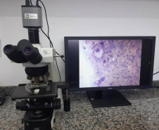 Paraná avança no combate ao câncer de colo do útero com ampliação da oferta do exame DNA-HPV para todo o Estado