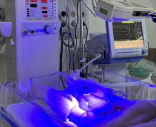 Hospitais da rede estadual implantam primeira UTI Neonatal Neurológica