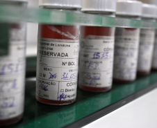 Doação de tecidos ajuda a recuperar queimados, tratar doenças e até devolver a visão