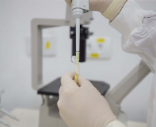 Tecpar submete à Anvisa pedido de registro da vacina contra varicela