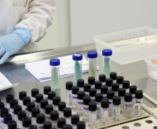 Marco de excelência nos serviços de saúde no Paraná, o Laboratório Central do Estado do Paraná (Lacen) se tornou também referência nacional para determinados exames, como os de resistência microbiana.  Foto: Antonio Américo/SESA - 13/05/2019
