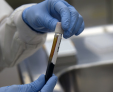 Marco de excelência nos serviços de saúde no Paraná, o Laboratório Central do Estado do Paraná (Lacen) se tornou também referência nacional para determinados exames, como os de resistência microbiana.  Foto: Antonio Américo/SESA - 13/05/2019