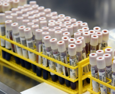 Marco de excelência nos serviços de saúde no Paraná, o Laboratório Central do Estado do Paraná (Lacen) se tornou também referência nacional para determinados exames, como os de resistência microbiana.  Foto: Antonio Américo/SESA - 13/05/2019
