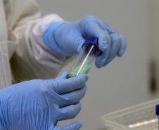 Marco de excelência nos serviços de saúde no Paraná, o Laboratório Central do Estado do Paraná (Lacen) se tornou também referência nacional para determinados exames, como os de resistência microbiana.  Foto: Antonio Américo/SESA - 13/05/2019