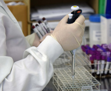 O Laboratório Central do Estado (Lacen Paraná), recebeu quinta-feira (5) 10 kits para o diagnóstico do novo coronavírus, quantidade suficiente para a realização de 240 testes. Esses kits foram encomendados pelo Ministério da Saúde, para a FioCruz (Fundação Oswaldo Cruz) e o Instituto de Biologia Molecular do Paraná (IBMP).Foto: Antonio Américo/SESA