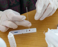 Governo distribui mais 178 mil testes rápidos aos municípios
