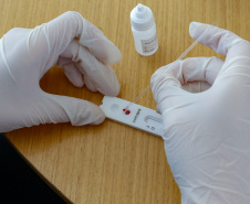 Governo distribui mais 178 mil testes rápidos aos municípios
