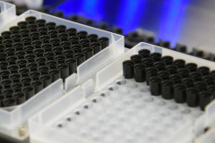 Laboratório de Análises Clínicas da UEM é referência no combate à tuberculose