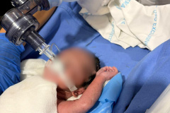 Resgate com Arcanjo 01 salva recém-nascido em parada cardiorrespiratória no Litoral