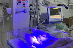 Hospitais da rede estadual implantam primeira UTI Neonatal Neurológica