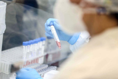 O sequenciamento genômico do vírus foi feito pela Fundação Oswaldo Cruz (Fiocruz) Rio de Janeiro. Destes novos casos, 15 foram identificados como sendo da P1, já circulante no Paraná e dois casos da variante B.1.1.7, identificada no Reino Unido.