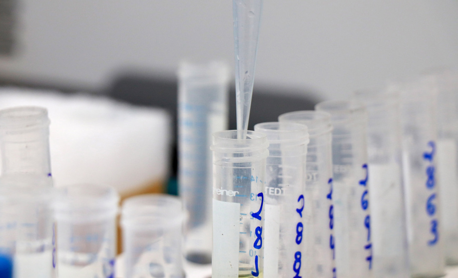 O Instituto de Tecnologia do Paraná (Tecpar), o Centro de Produção e Pesquisa de Imunobiológicos (CPPI) e a Fundação Estatal de Atenção em Saúde do Estado do Paraná (Funeas) buscam oportunidades de atuação em conjunto em projetos de Pesquisa e Desenvolvimento (P&D), de forma a trazer, de maneira mais eficiente, novas soluções para a área da saúde para o Paraná.- Curitiba, 11/11/2021 - Foto: Tecpar