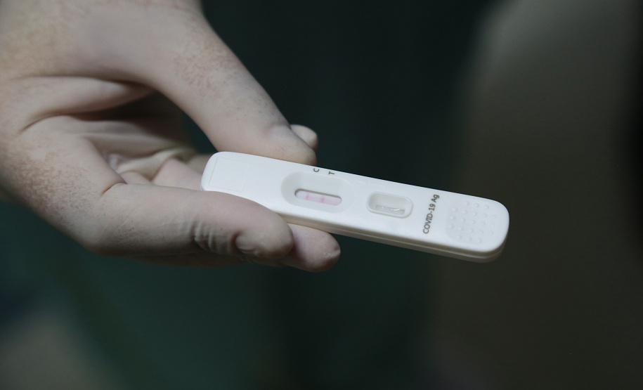 Saúde envia mais 464 mil testes para diagnóstico da Covid-19