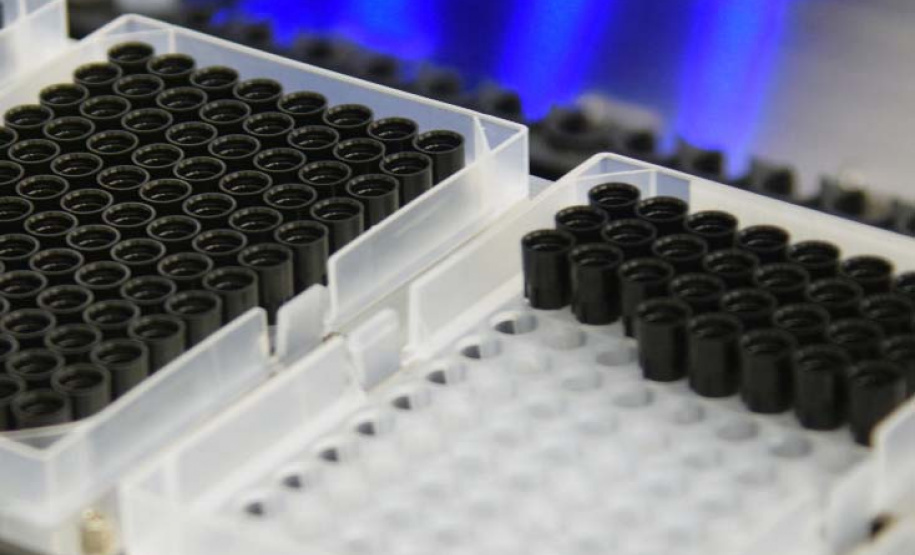 Laboratório de Análises Clínicas da UEM é referência no combate à tuberculose