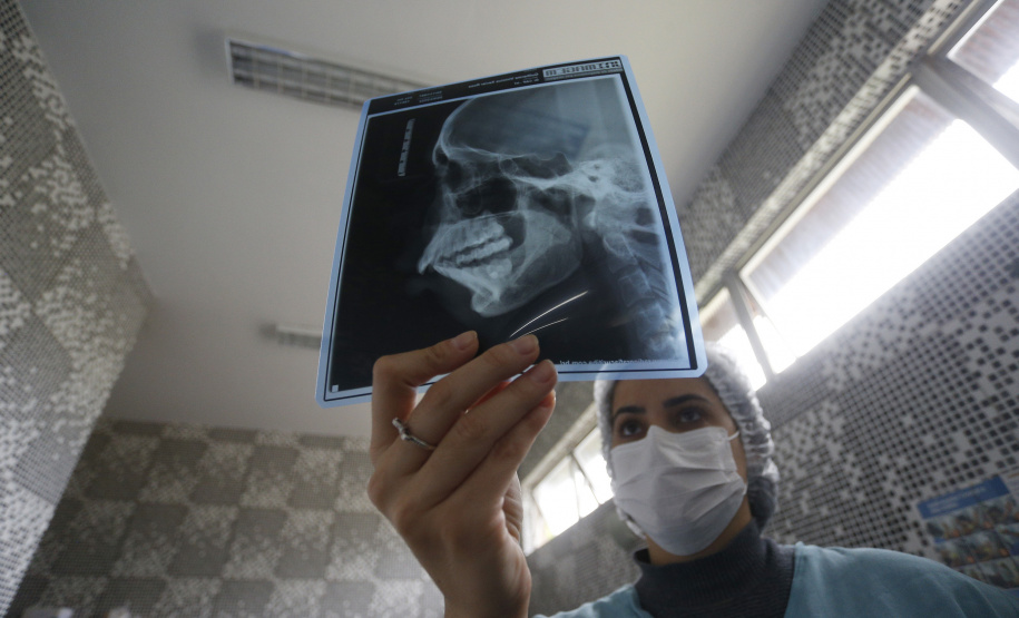 Caif volta atender 100% pacientes com malformação facial