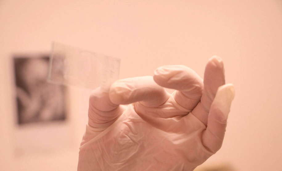 Outubro Rosa: ambulatório do HU-UEPG realiza coleta de preventivo em servidoras