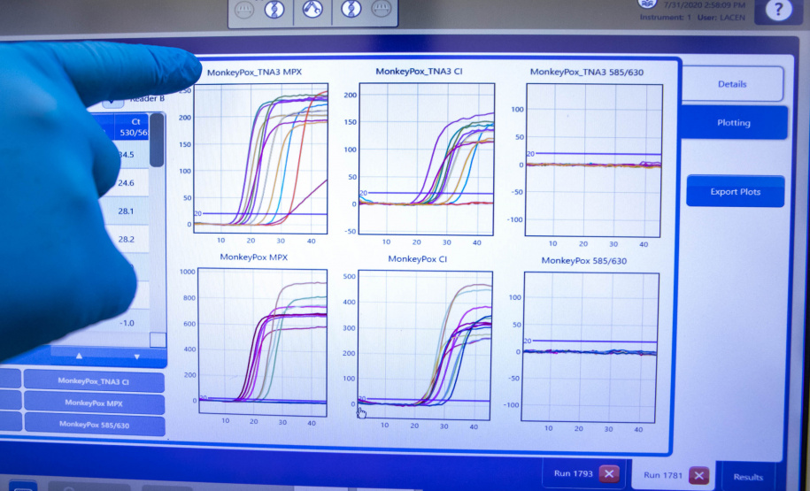 Secretaria de Saúde registra mais cinco casos de Monkeypox