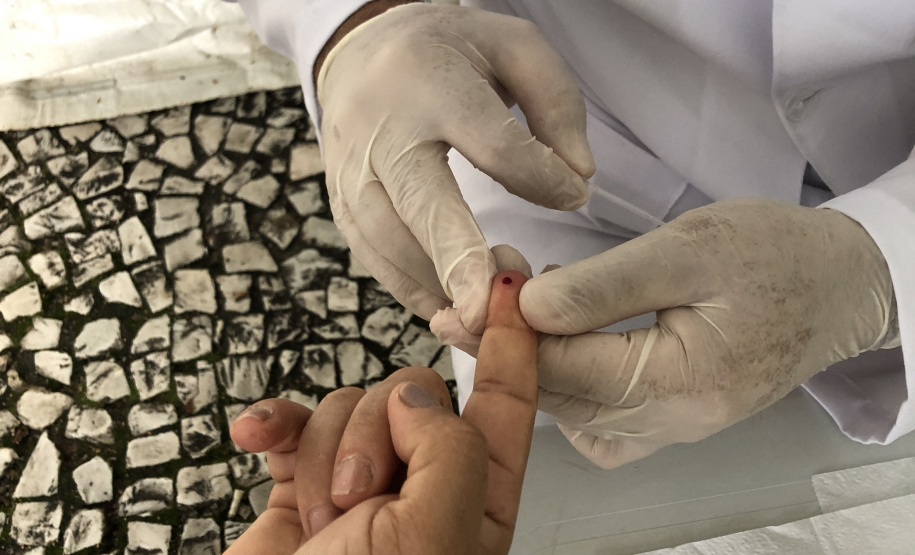 Sesa promove ações para diagnóstico precoce e prevenção do HIV/AIDS no Dezembro Vermelho