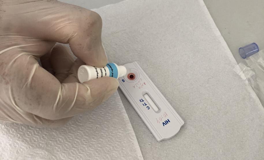 Sesa promove ações para diagnóstico precoce e prevenção do HIV/AIDS no Dezembro Vermelho