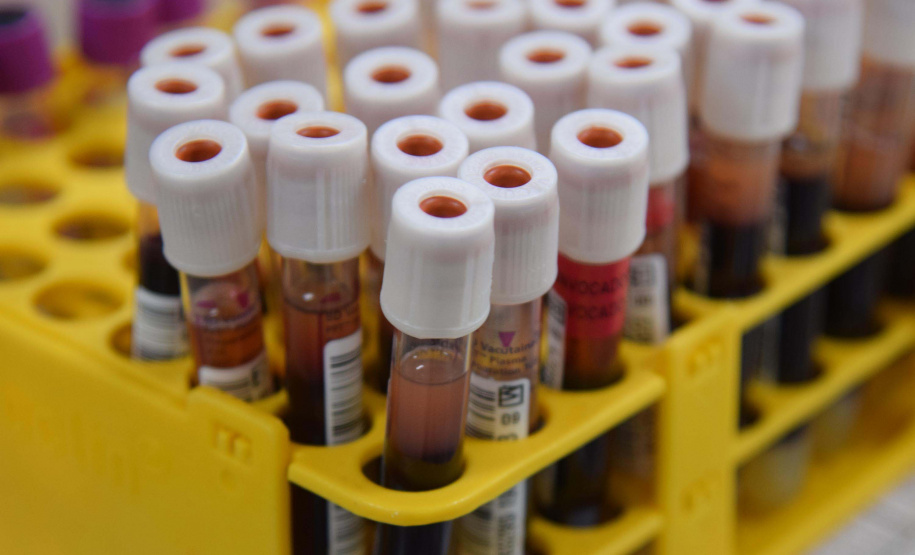 Hemepar reforça importância da doação