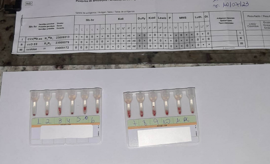 Tratamento especializado ofertado pelo Hemepar amplia qualidade de vida de pacientes com Anemia Falciforme e Talassemia