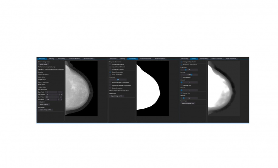 Software desenvolvido na UEL avalia progressão e tratamento do câncer de mama