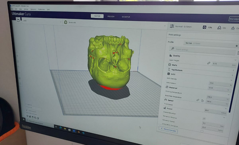 POLÍCIA CIENTÍFICA CRÂNIO 3D