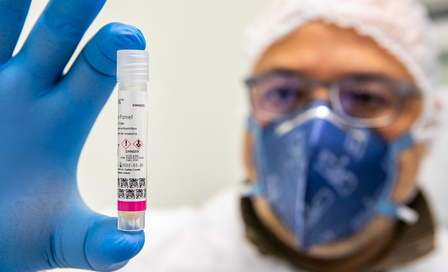 Lacen processa 13.298 amostras para vírus respiratórios em seis meses