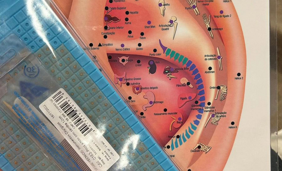 Atendimento SUS: curso forma profissionais da saúde para aplicação da técnica de auriculoterapia