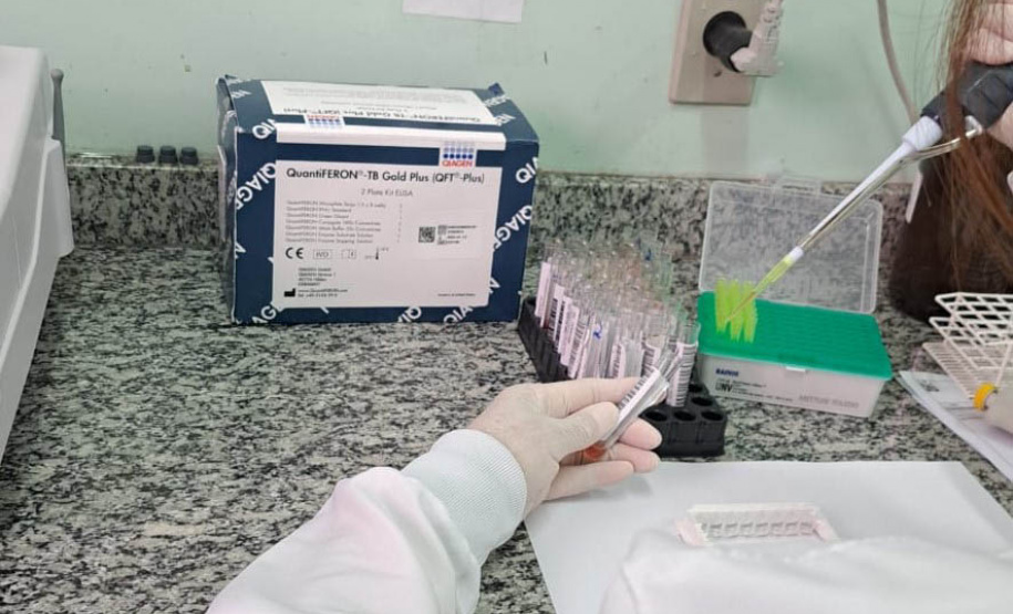 Controle da tuberculose tem importante avanço no Paraná com aumento de 43% no tratamento preventivo
